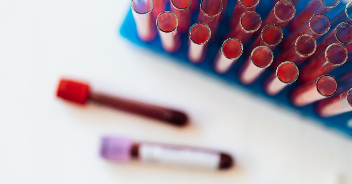 Blood sample tubes in a laboratory rack, the testing behind testosterone, thyroid and other causes of a stall