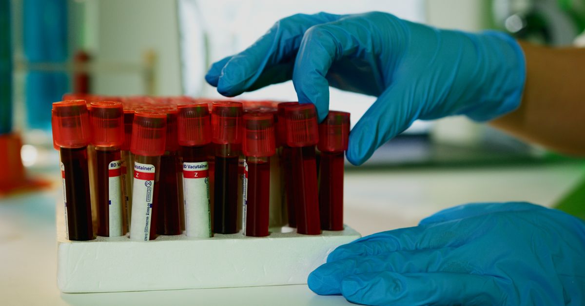 Does Inflammation Really Slow Down Your Metabolism?