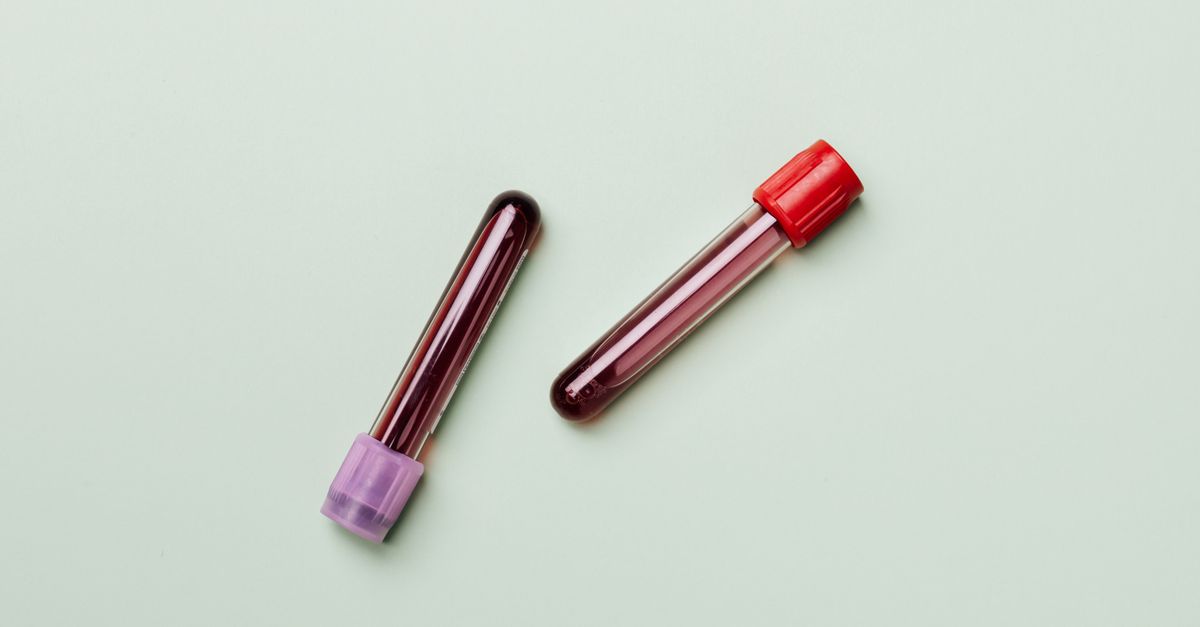 Two capped blood sample tubes on a pale green surface, the blood test used to diagnose hypothyroidism