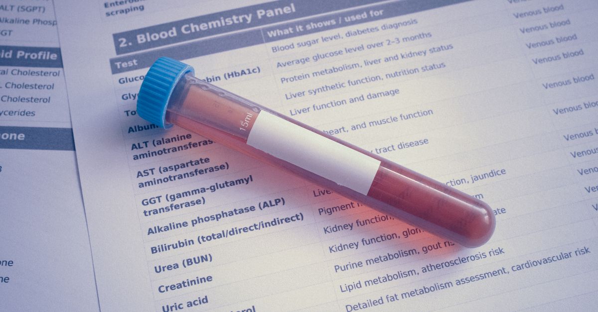 Does Vitamin D Affect Your Metabolism and Weight?
